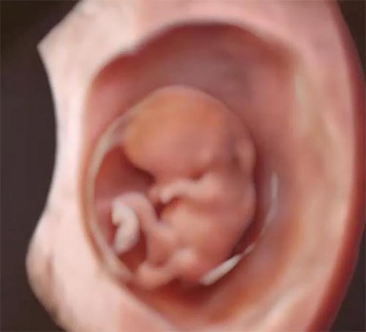 Pre初期ドックの写真