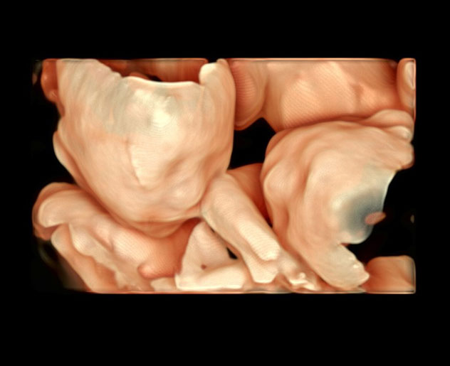 3D/4Dエコーはありますか?の写真