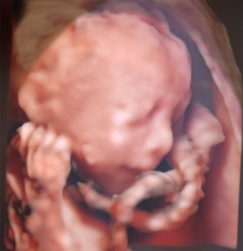 中期ドックの写真