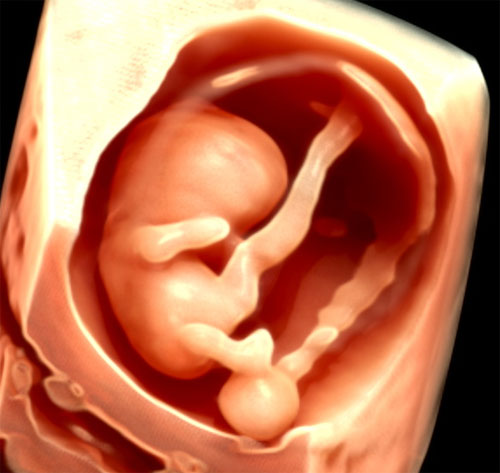 Pre初期ドックの写真